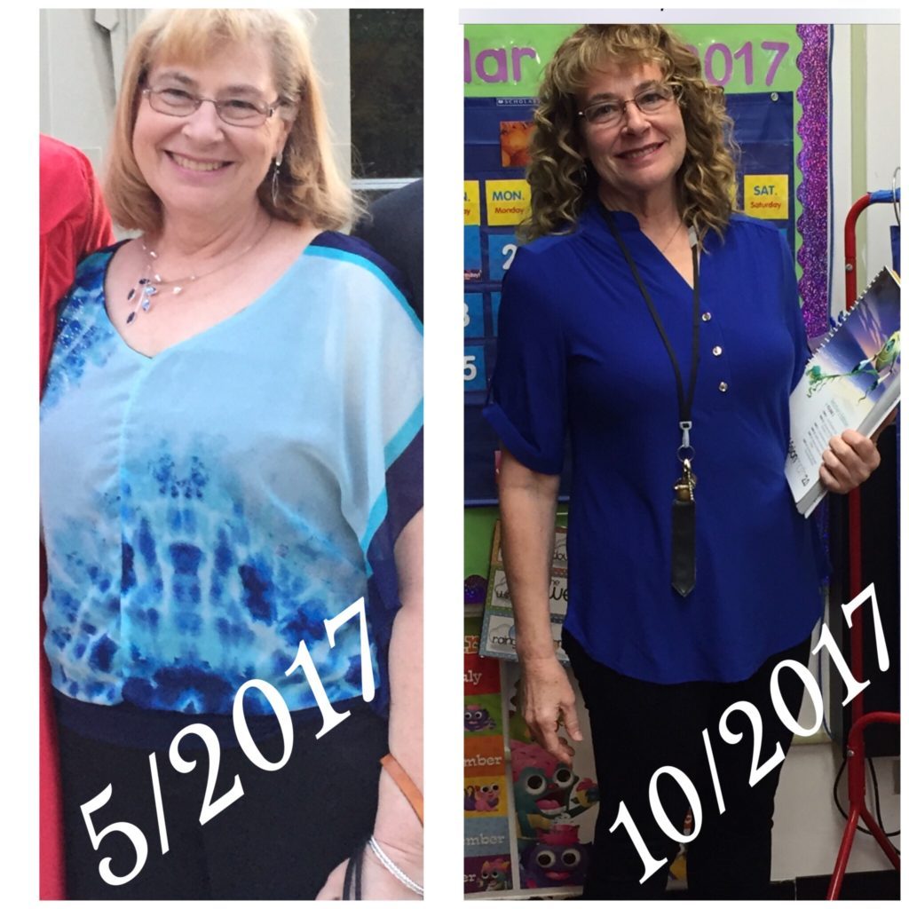 Mary-before-and-after-1024x1024
